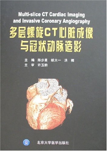 多层螺旋ct心脏成像与冠状动脉造影