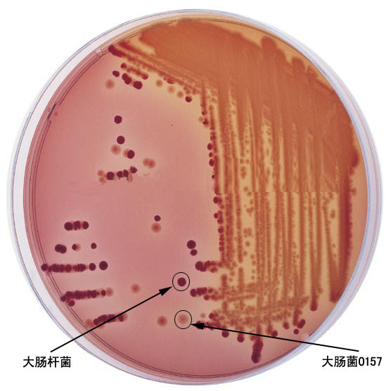 data-lemmaid="10981759">麦康凯琼脂 /a>培养基或是麦康凯培养基