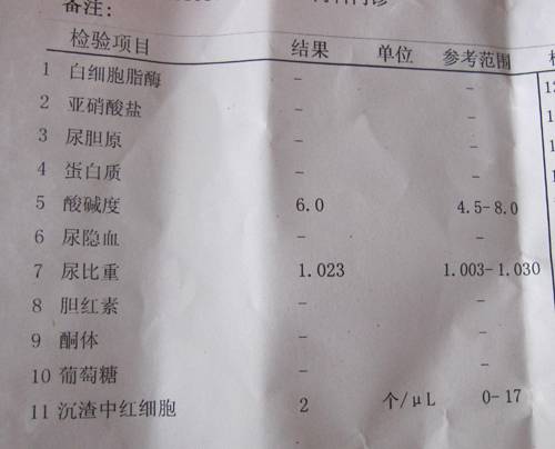 24小时尿蛋白定量