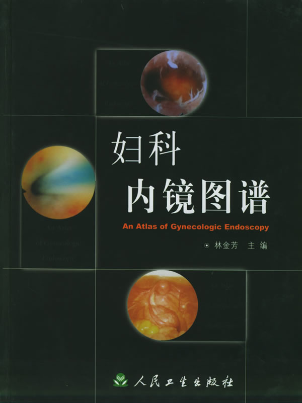 妇科内镜图谱