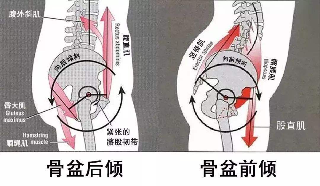 较正确的骨盆位置向后倾斜一定的角度