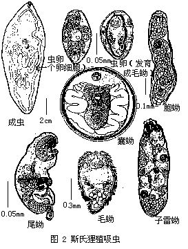 并殖吸虫属