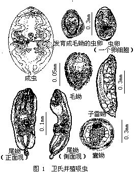 并殖吸虫属