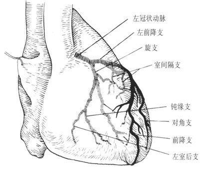 p>冠状动脉造影是诊断冠状动脉粥样硬化性心脏病(冠心病)的一种常用