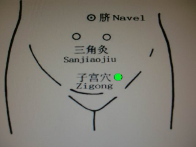 子宫穴