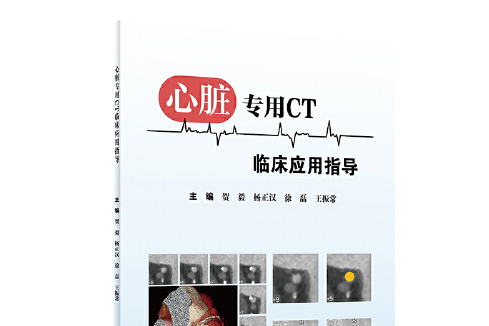 心脏专用ct临床应用指导