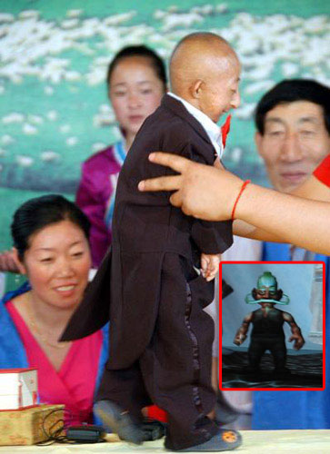 侏儒视频 全网资源