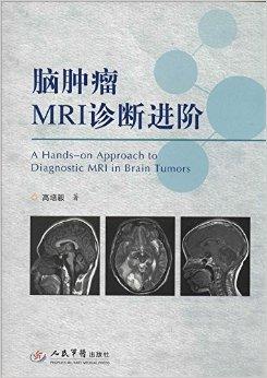p>本书是根据在首都医科大学附属北京天坛医院神经影像中心工作多年