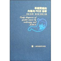 早期胃癌的内镜与fice诊断