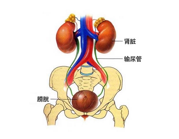 泌尿系统结石