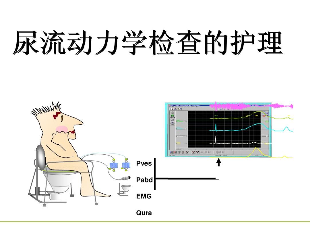 尿流动力学