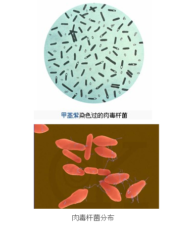 p>肉毒梭菌检测是指 a target"_blank href/item/肉毒梭状芽孢