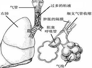 气管隆突以上的损伤