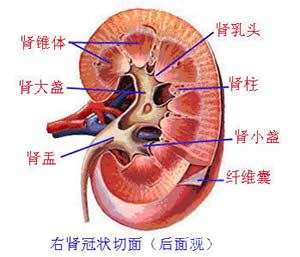 高胱氨酸尿症