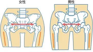 髋部最宽点上升,接近大转子外突点;绝非体态矫正使大转子间宽小于髂嵴