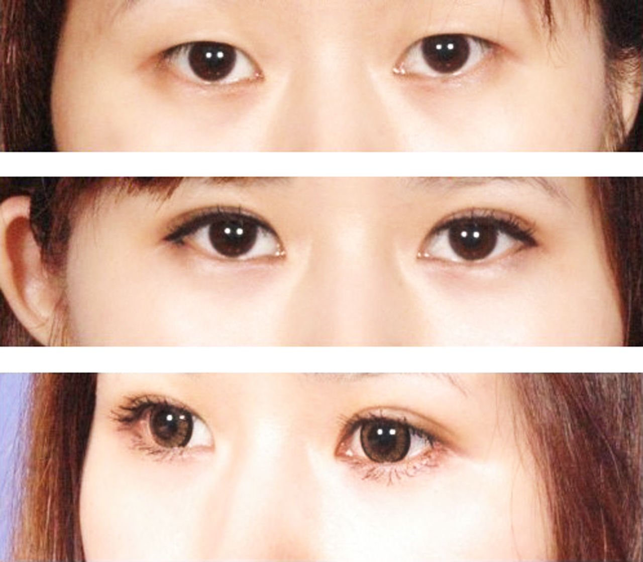 Ϻ޸˫Ƥҽ_˫Ƥ޸۸_ȫ˫ʧ޸ͼ