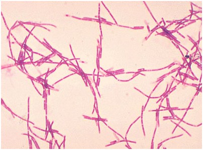 包括对人和动物致病的 a href="#" data-lemmaid="866734">炭疽芽孢