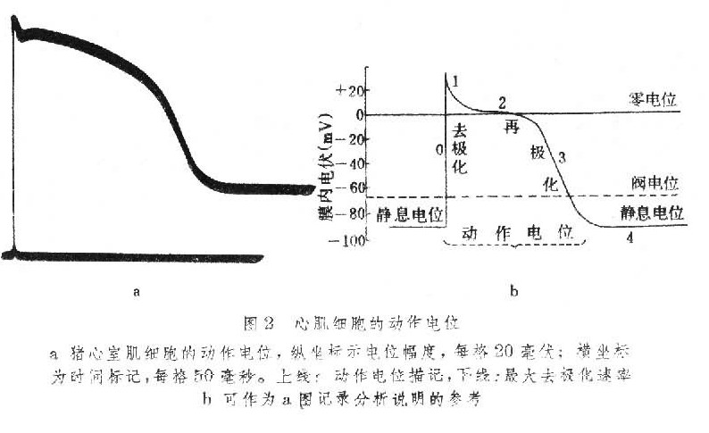 心肌疾病是指除心脏瓣膜病,冠状动脉粥样硬化性心脏病,高血压心脏病