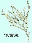 p>假菌丝 pseudohyphae)指某些酵母如假丝酵母,为出芽繁殖其子细胞