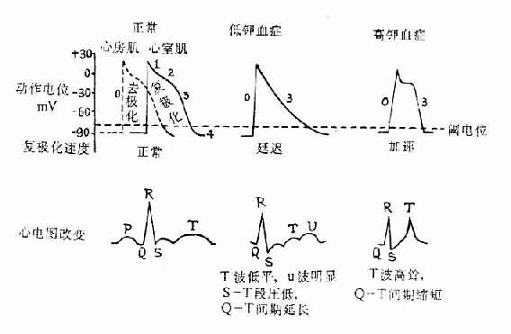 其临床特征为严重的低钠血症和代谢性碱中毒,伴有高肾素高醛固酮血症