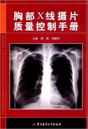 现在胸部x线检查在诊断结核病中的作用日益提高,对肺结核可疑症状者