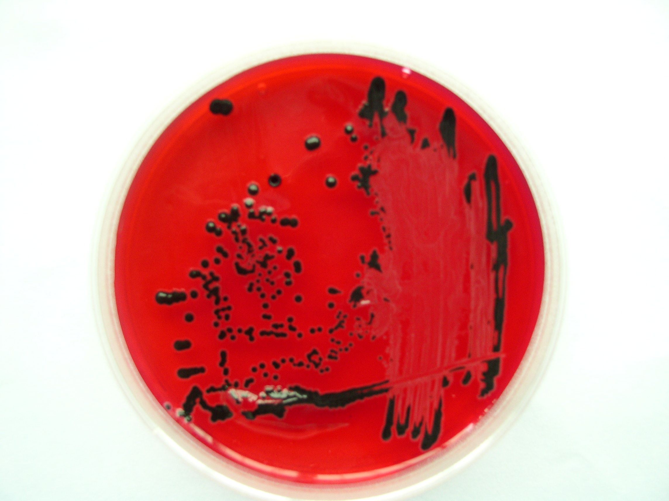 ">高氏 /a>一号 a target="_blank" href="/item/培养基/1317328"