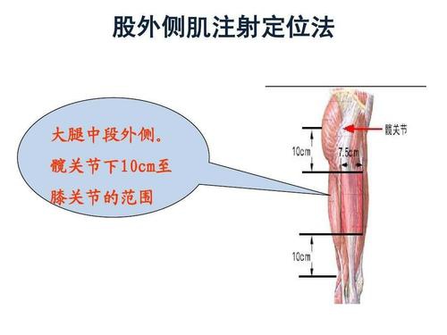股外侧肌注射术