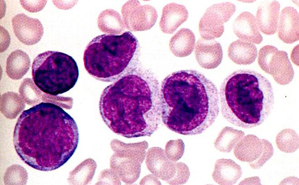  p data-id="gnvekyjc0r">髓细胞(myeloid,髓样)是指涉骨髓或 a