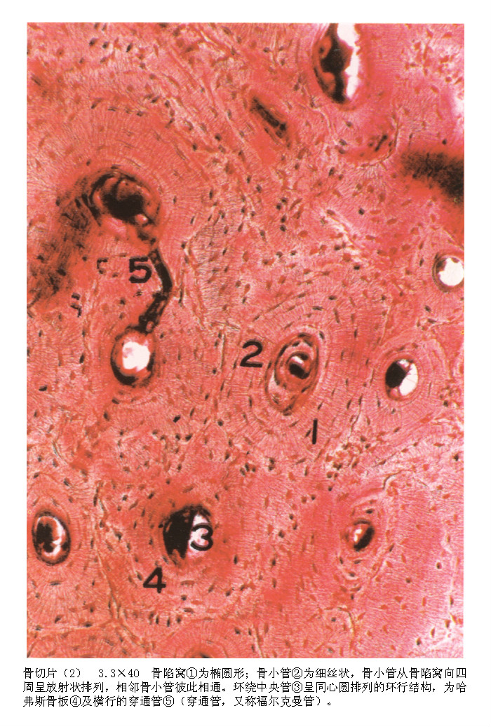  p>动物体骨密质中,在外环骨板层可见与骨干相垂直的孔道,横向穿行于