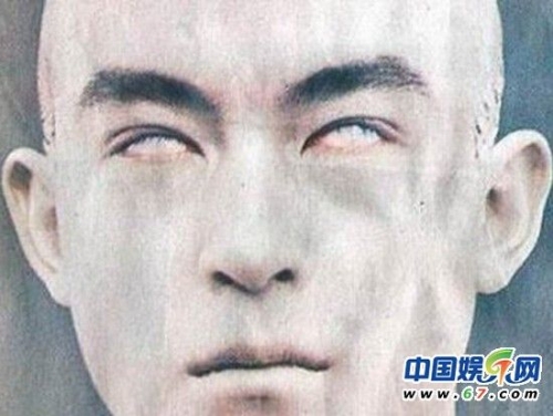 新型眼保健操