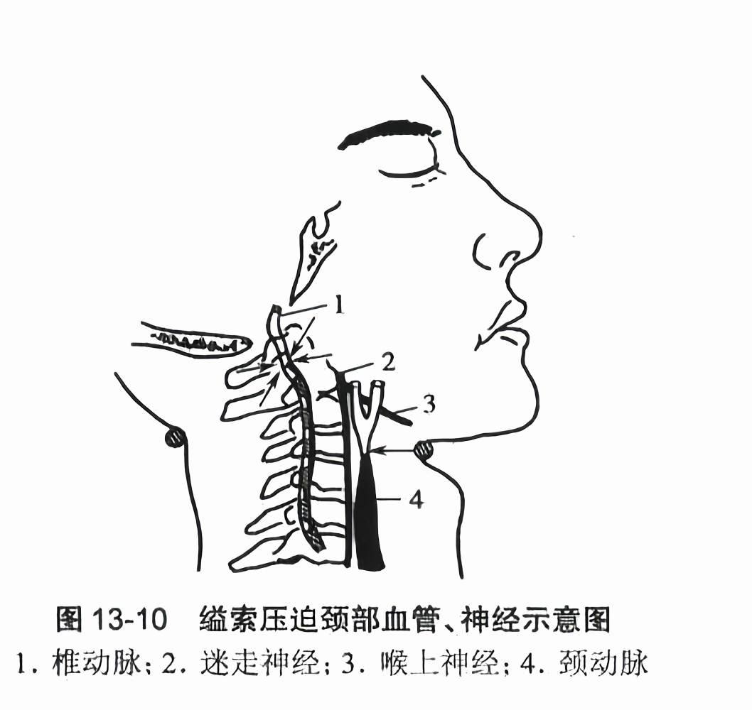 缢死_百度百科