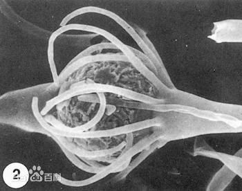  p> b>根霉属(rhizopus) /b>原接合菌门,现 a target="_blank" href="