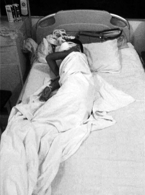 8·24山西临汾男童被挖眼案