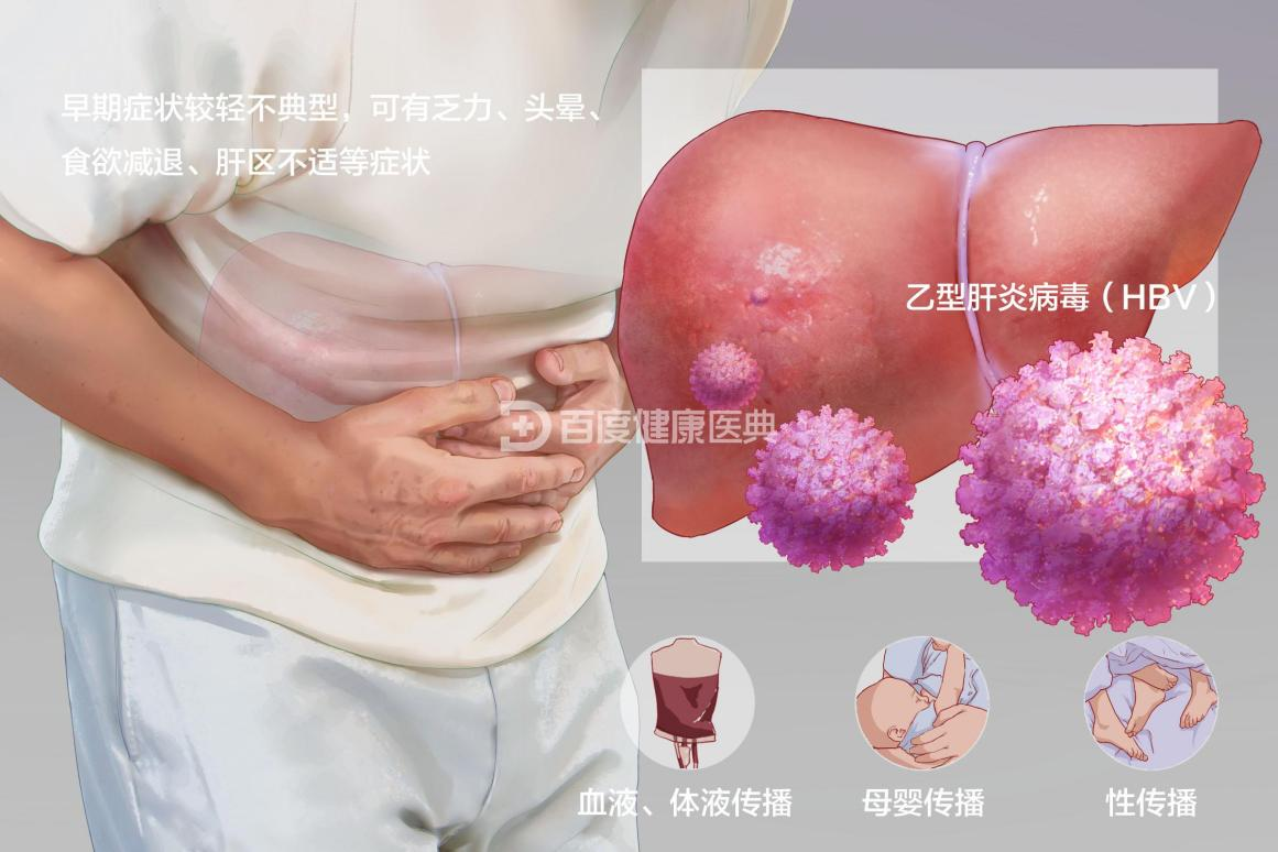 慢性乙型病毒性肝炎