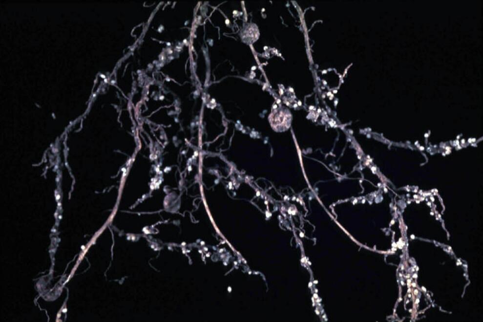 菜用大豆孢囊线虫病