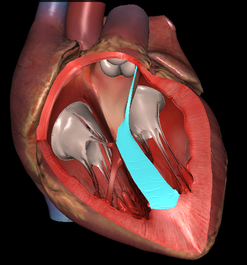 称肌部;其后上方为一不规则的膜性组织,称膜部,为室间隔缺损的好发