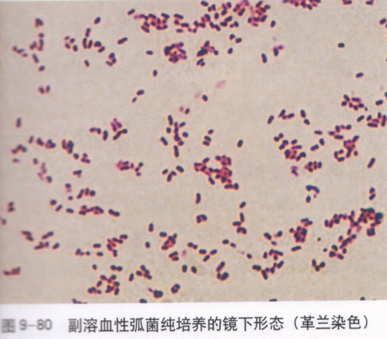  p>副溶血性弧菌(vibrio parahemolyticus),为革兰氏阴性杆菌,呈弧状