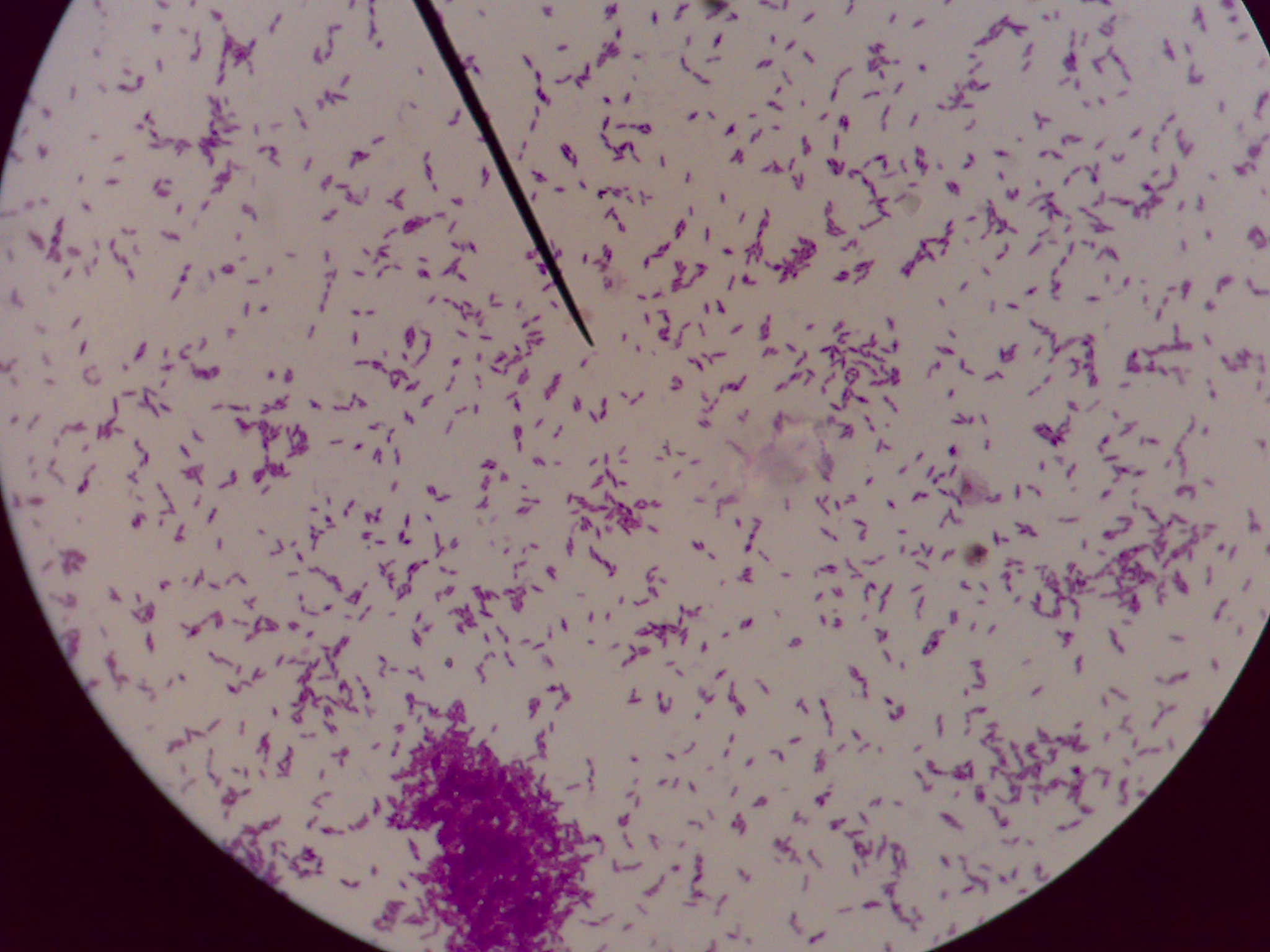革兰氏阳性菌感染