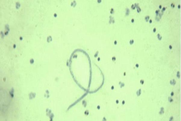  p>班氏吴策线虫微丝蚴是丝虫科,副丝属微生物. /p>