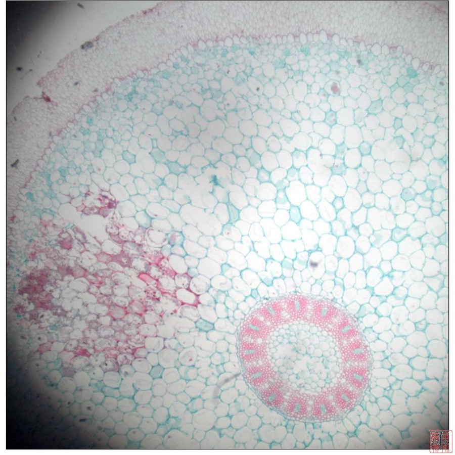  p>周皮是取代表皮的次生保护组织,存在于加粗生长的根和茎的表面,是
