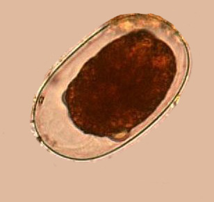 十二指肠钩口线虫和美洲板口线虫