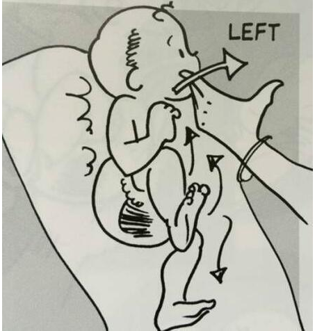  p>强直性颈部反射(tonic neck reflex),又名不对称颈紧张反射,是人类