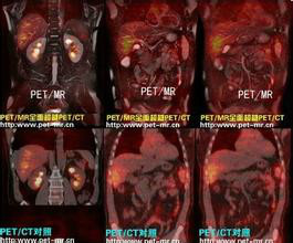 pet/ct