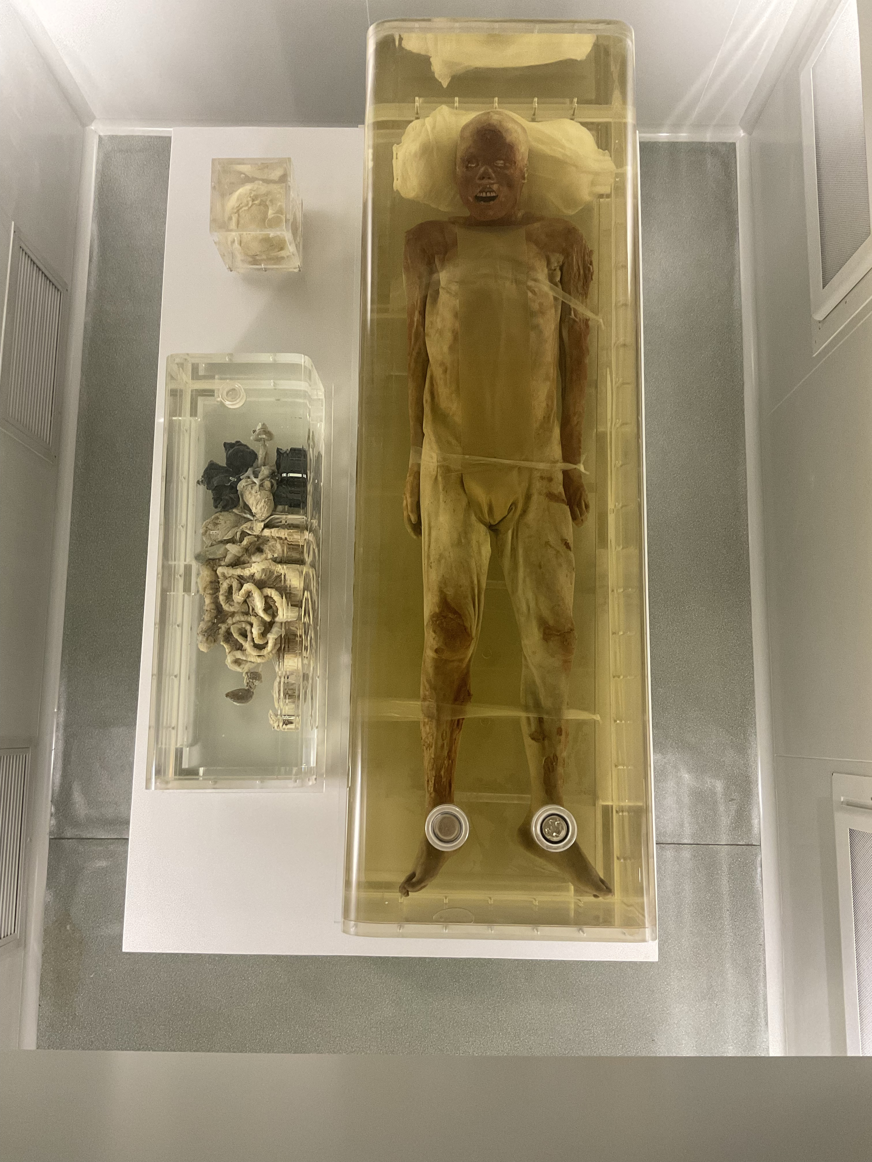 荆州凤凰山西汉男尸