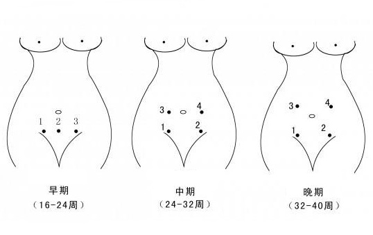 胎音听诊器