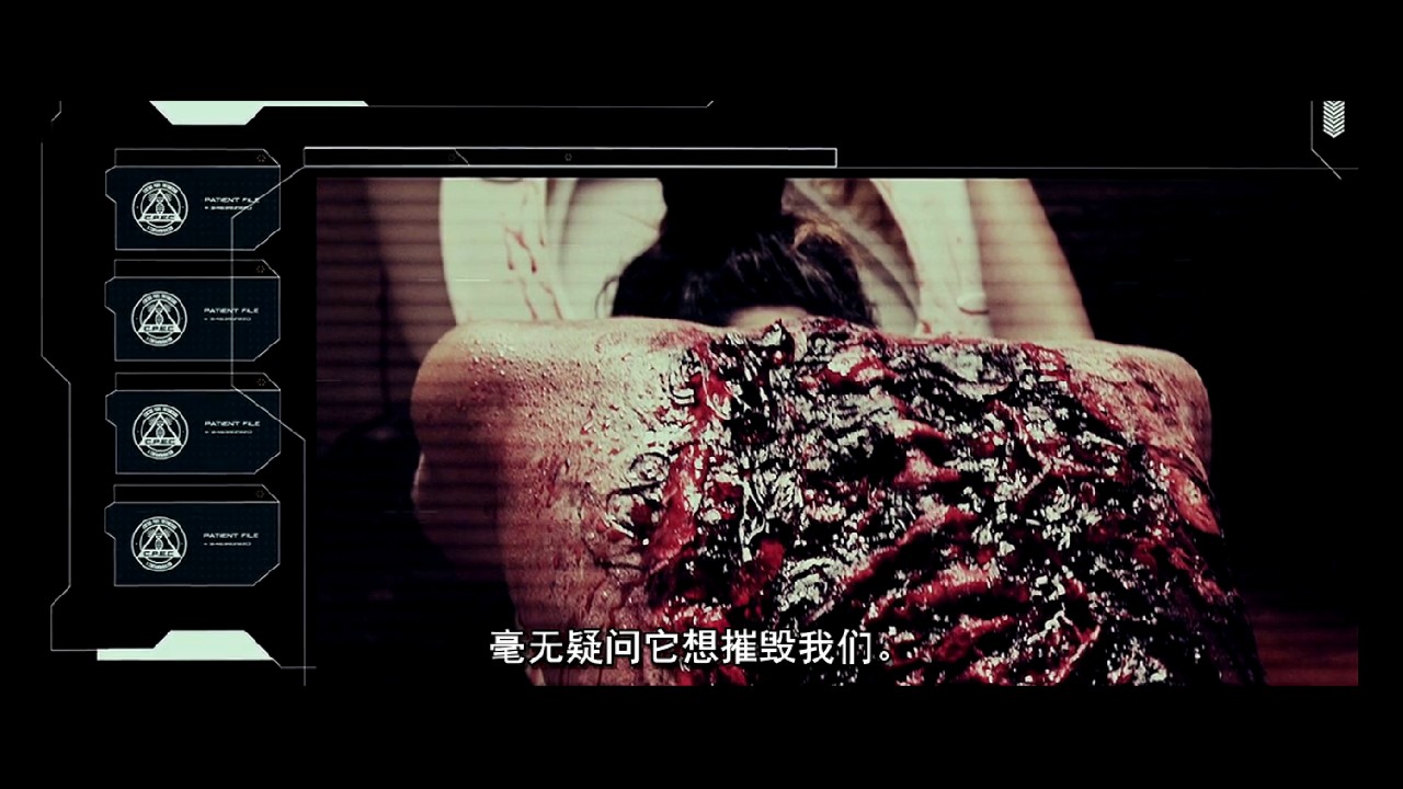 尸骨无存3零号病人