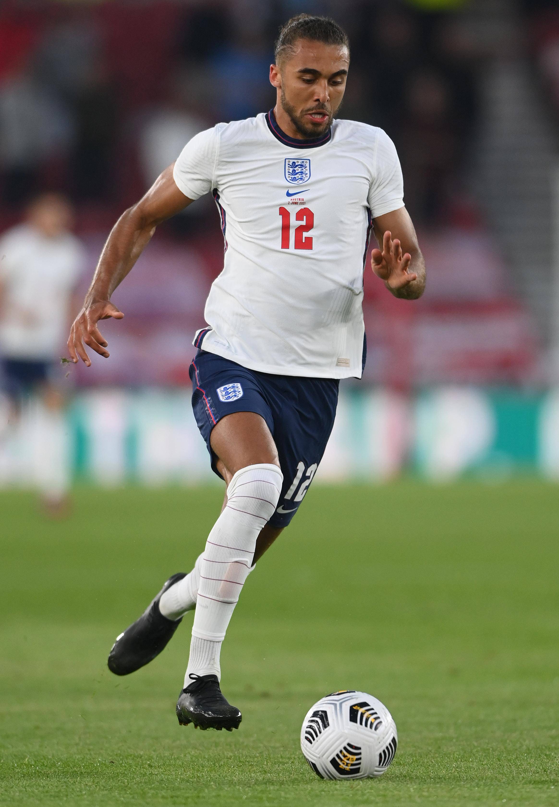 id="gnbk102dhx">多米尼克·卡尔弗特-卢因(dominic calvert-lewin