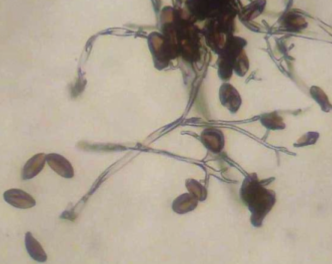  p>丝瓜霜霉病是由古巴假霜霉引起的,发生在 a target="_blank" href=