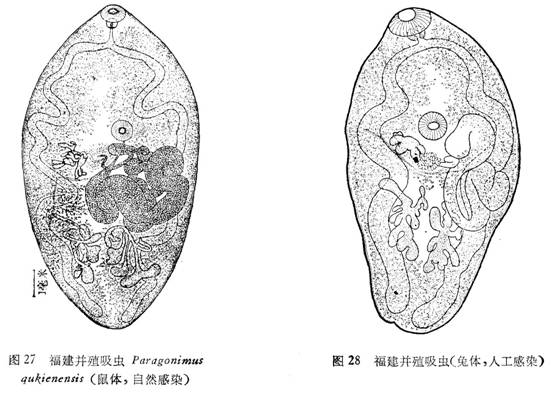 福建并殖吸虫