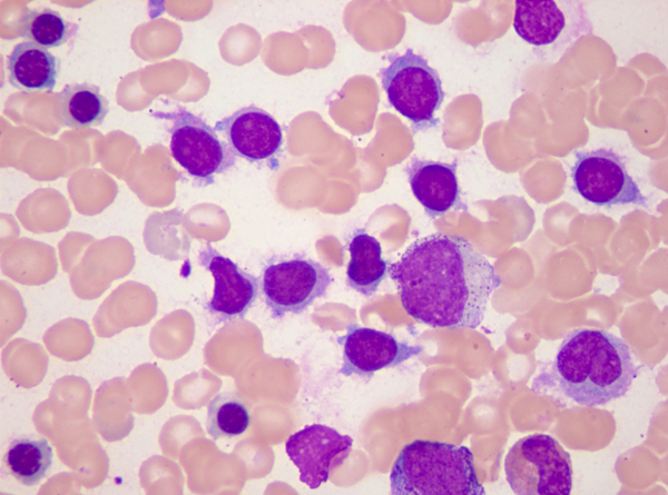  p data-id="gnwlxbn6yd">毛细胞为感受 a targ